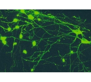 В гиппокампе обнаружены «нейроны храбрости»